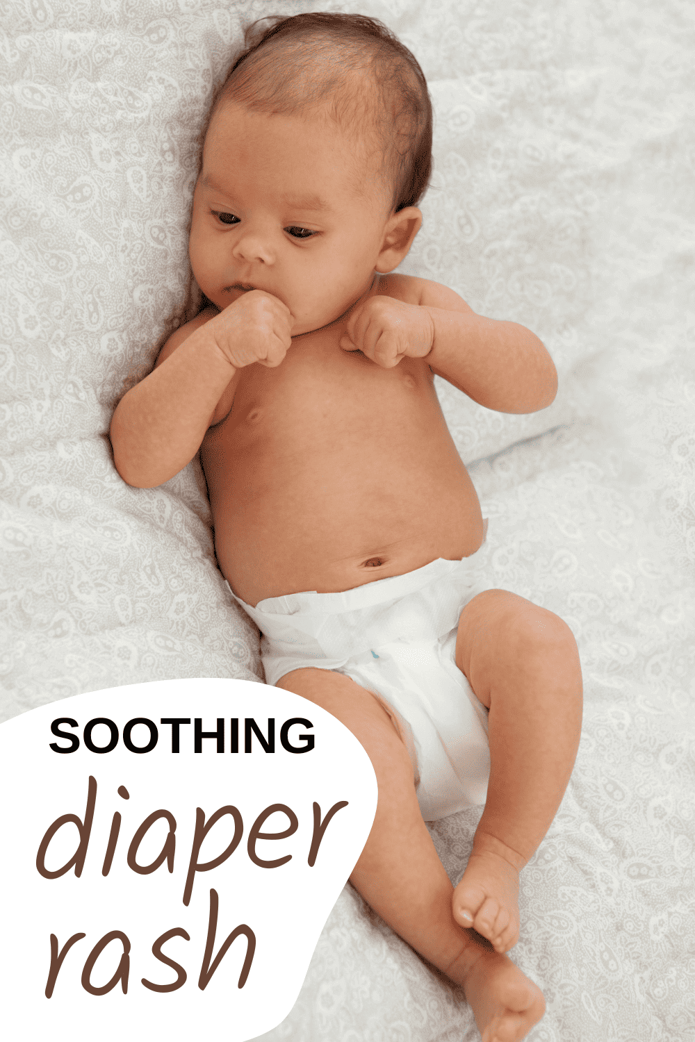 Soothing Baby’s Diaper Rash